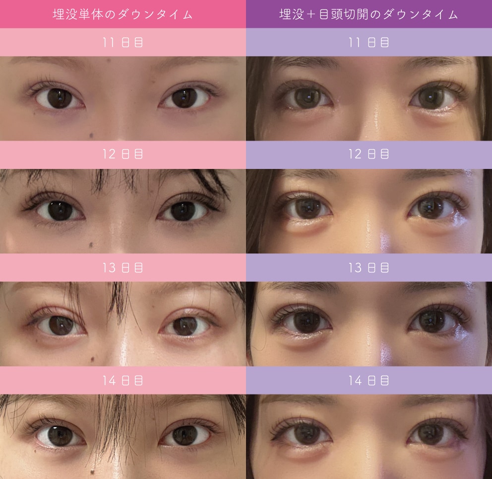 11〜14日比較