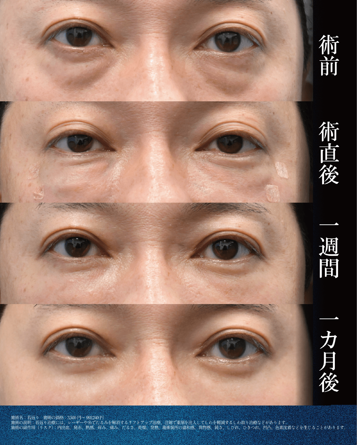 症例写真