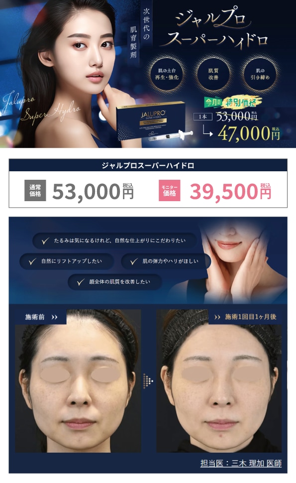 ジャルプロ