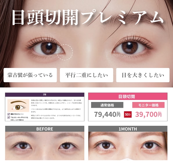 目頭切開