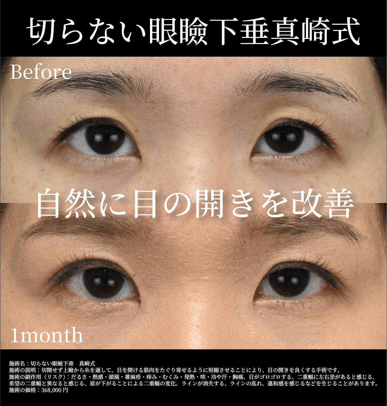 症例写真