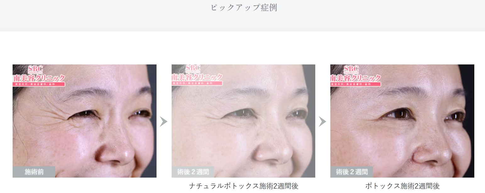 しわ2