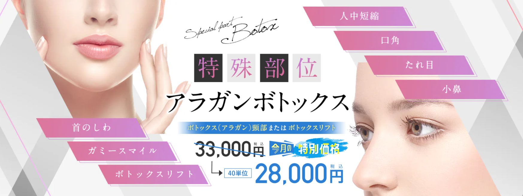 頸部ボトックス