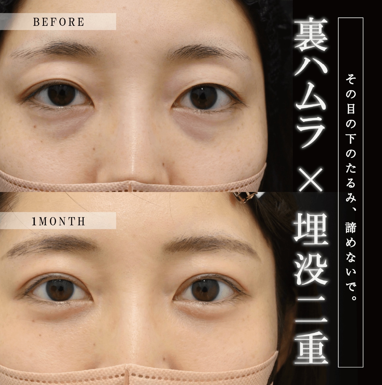 中谷先生症例写真2