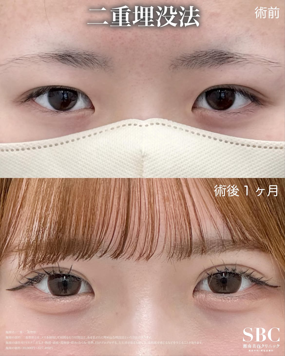 樋口先生症例写真1