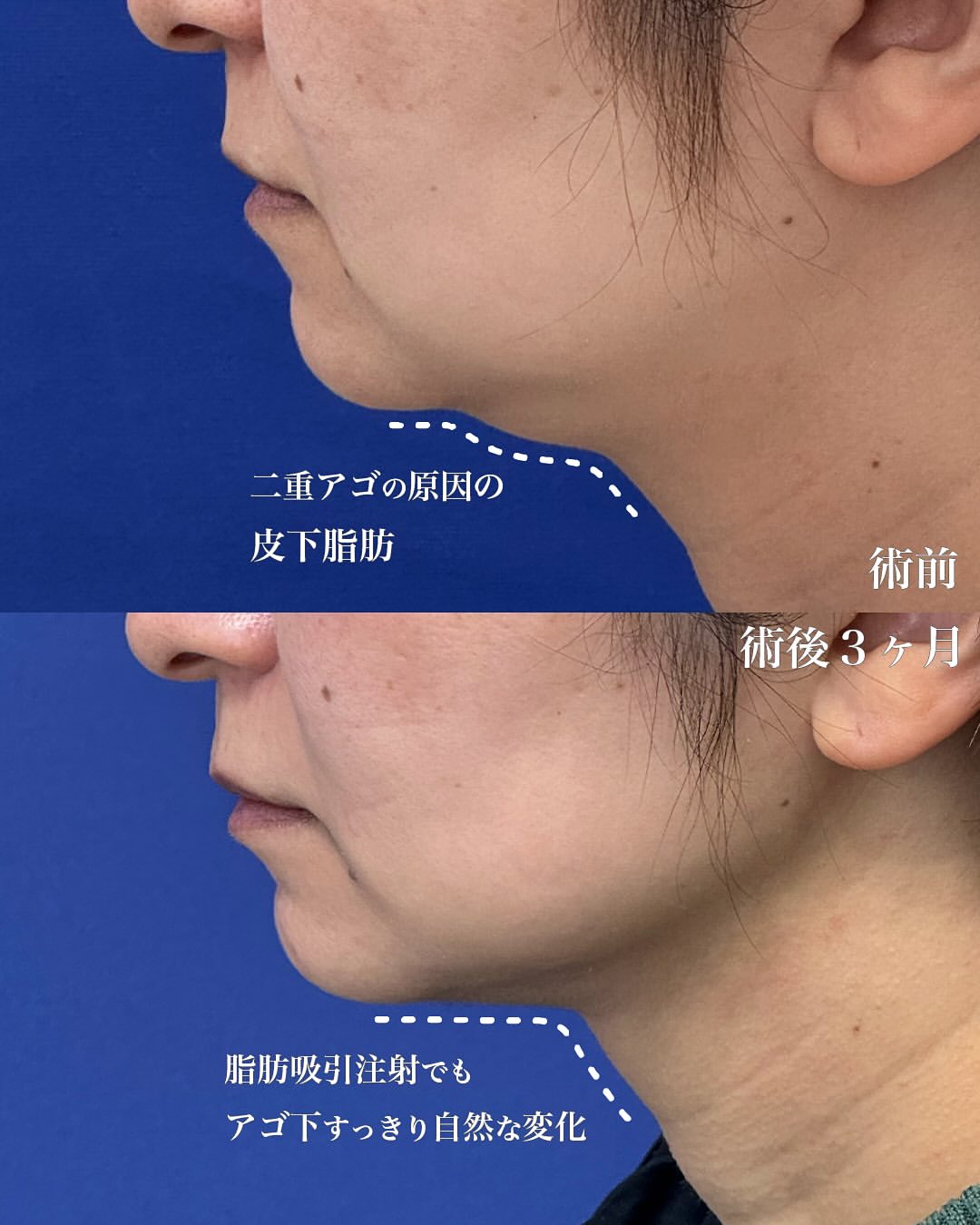 樋口先生症例写真2
