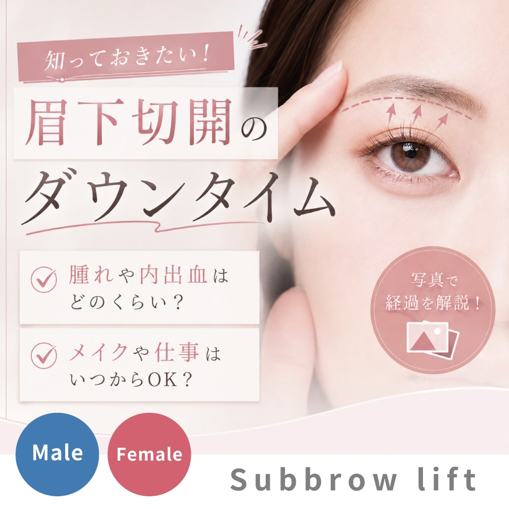 【上野・東京エリア】眉下切開のダウンタイムはどれくらい？術後の不安を解消する【完全ガイド】眉下切開症例数全国2位の医師が監修（2026年上半期SBC内）
