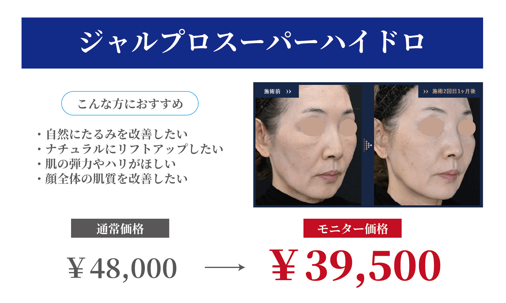 ジャルプロ価格