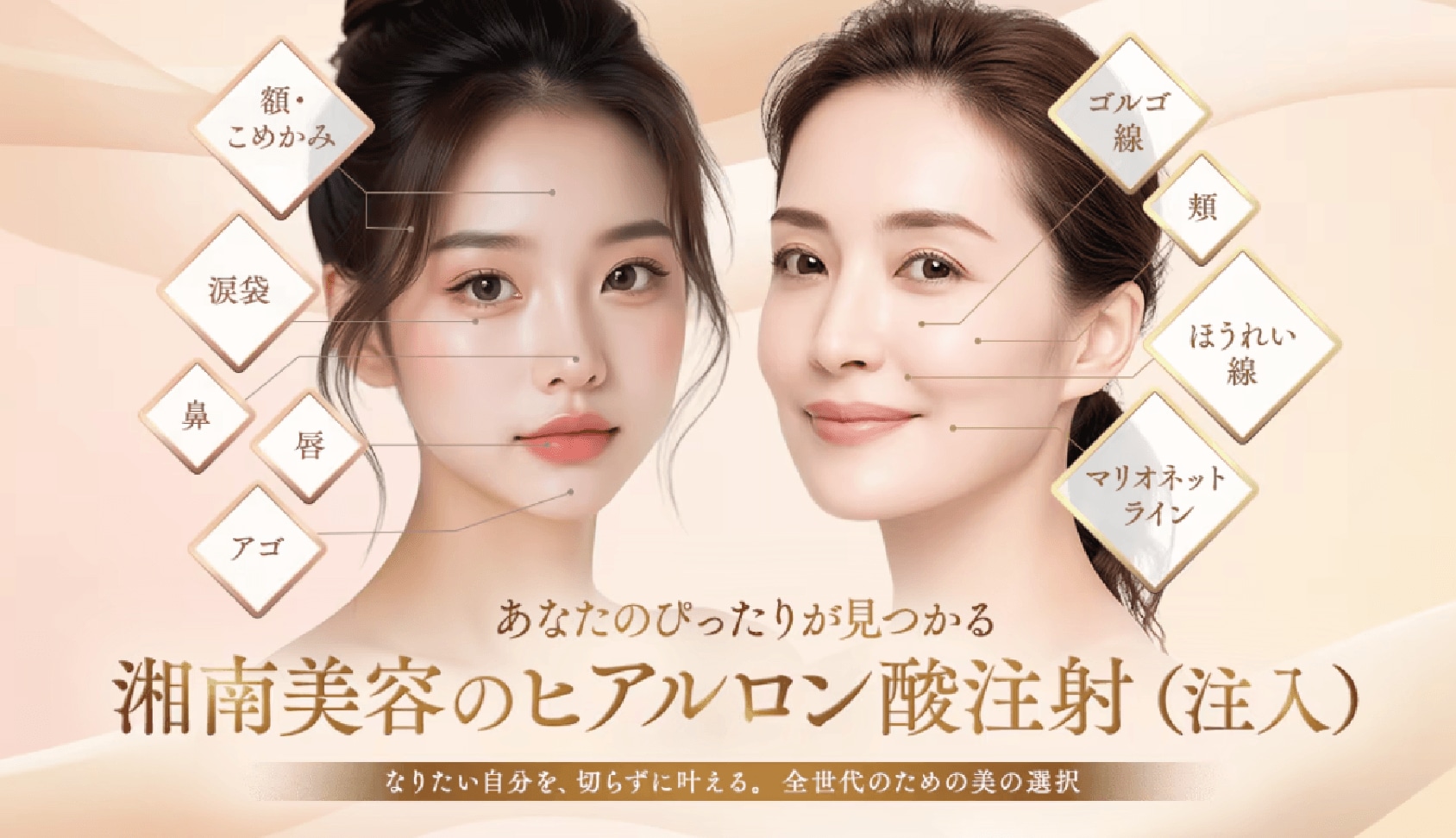 ヒアルロン酸