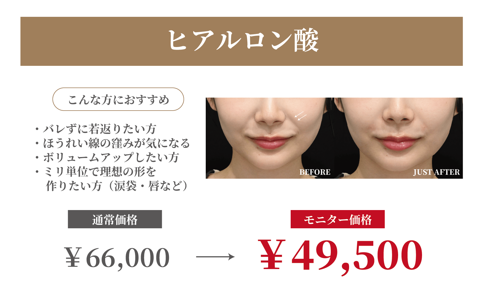 ヒアルロン酸価格