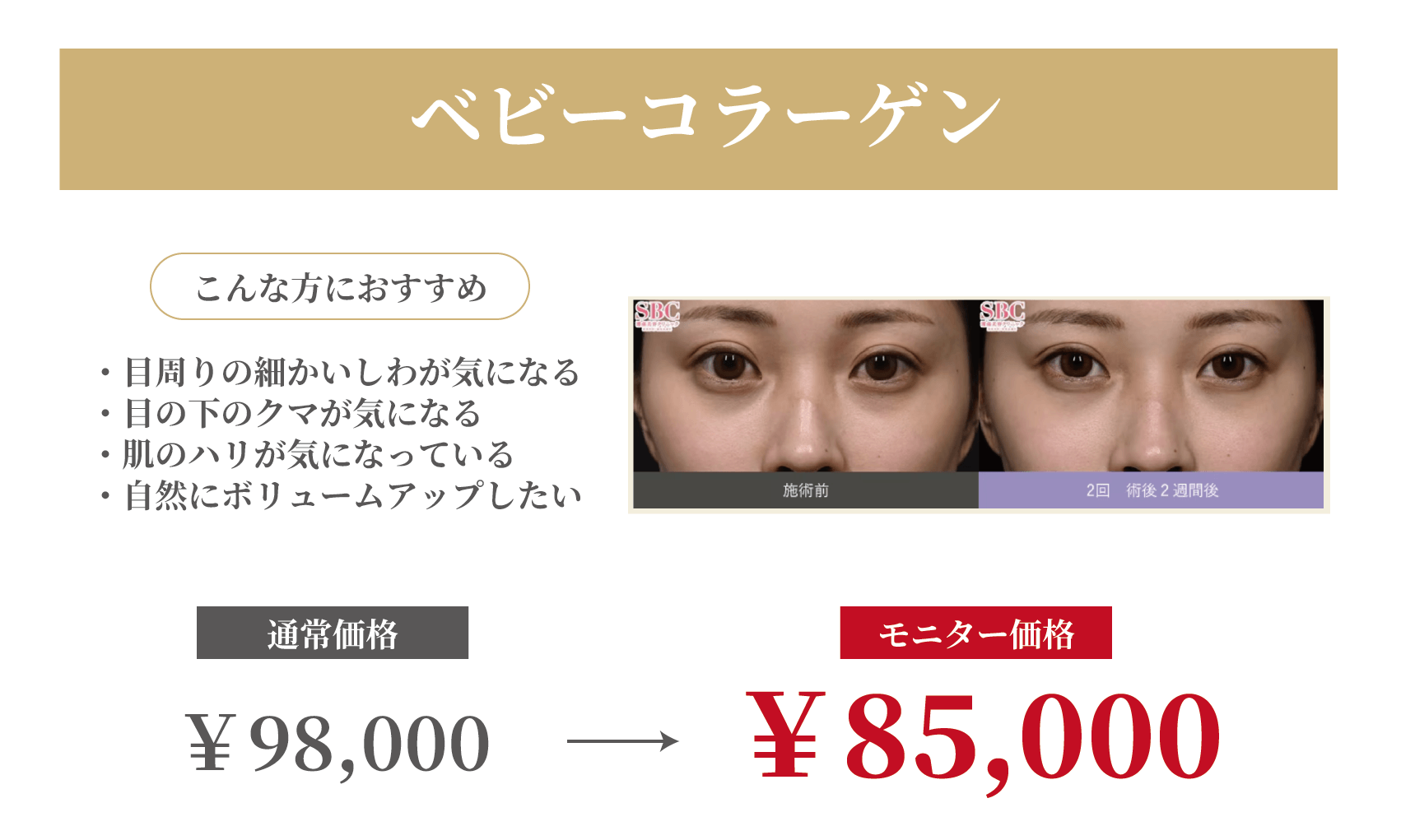 ベビコラ価格