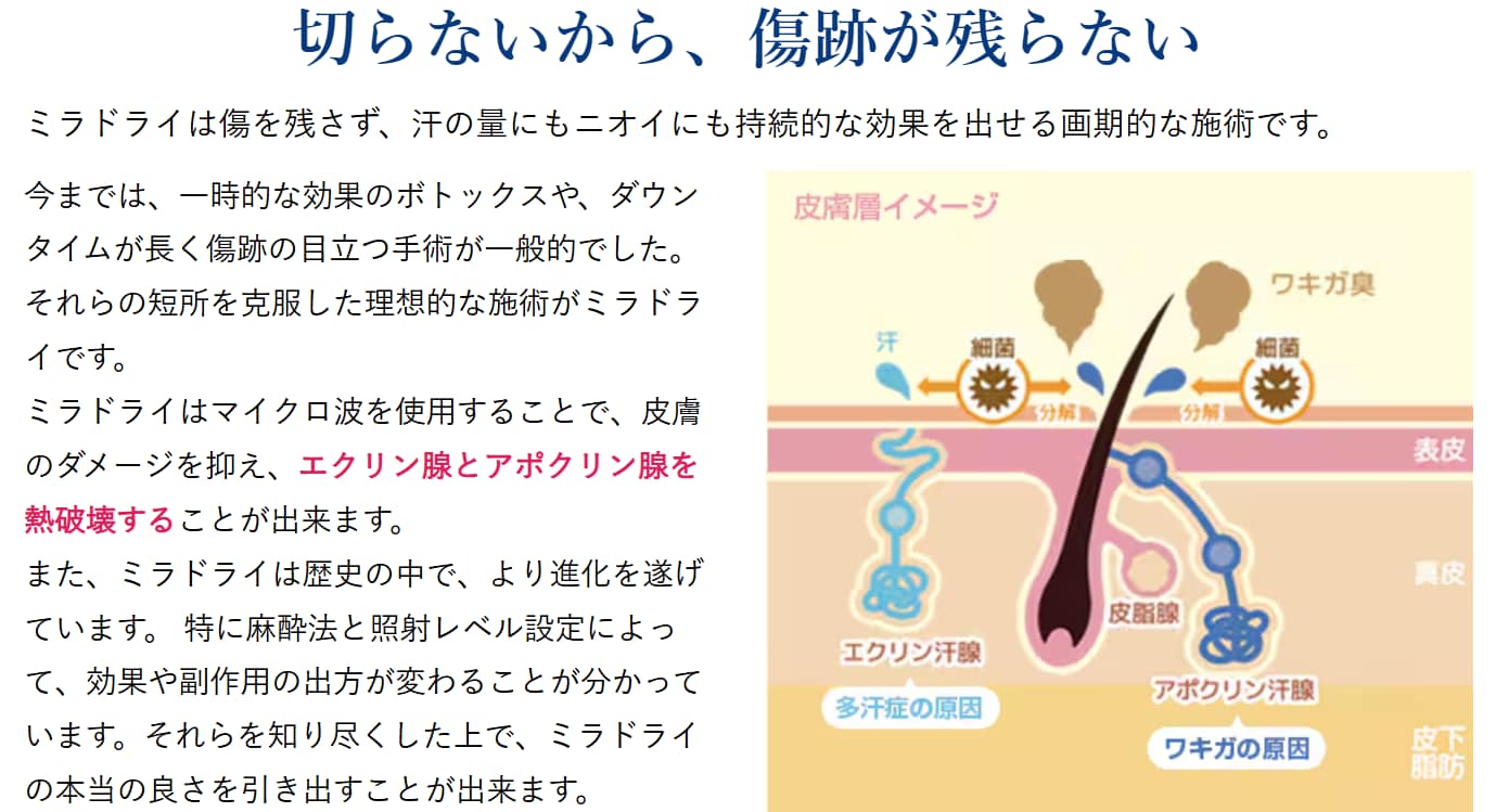 ミラドライのメリット