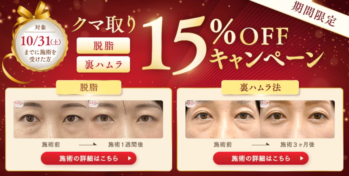 クマ治療15％OFFキャンペーン