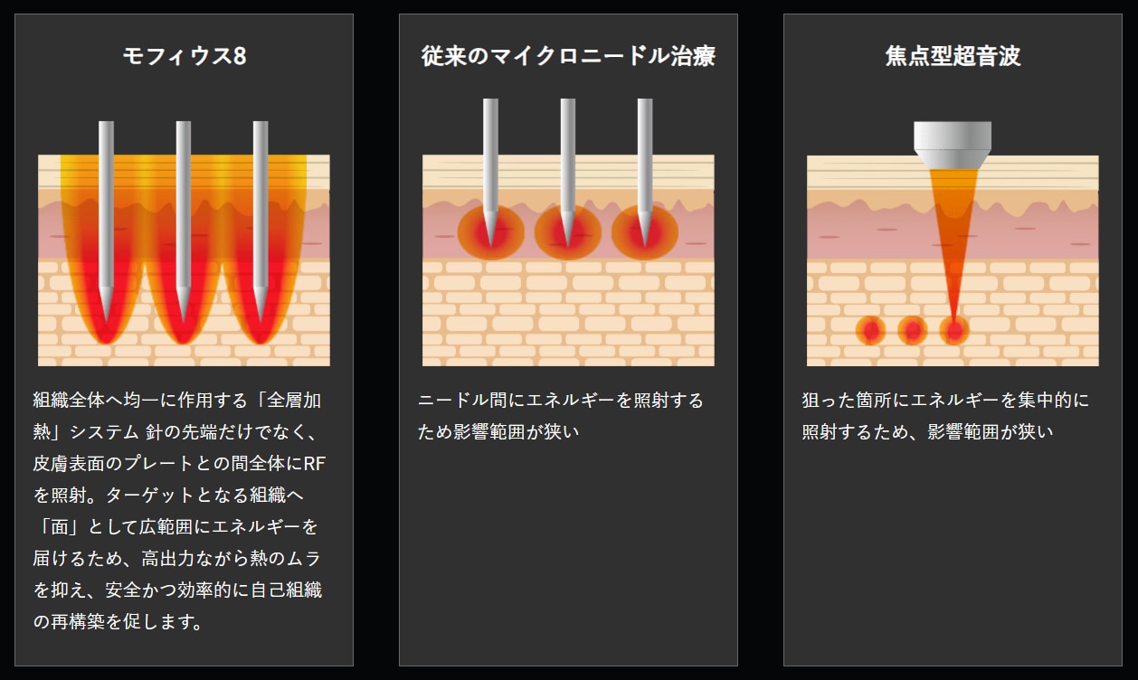 従来機器とモフィウス8の違い