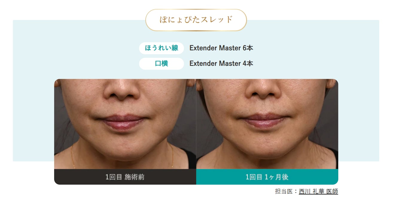 症例写真1