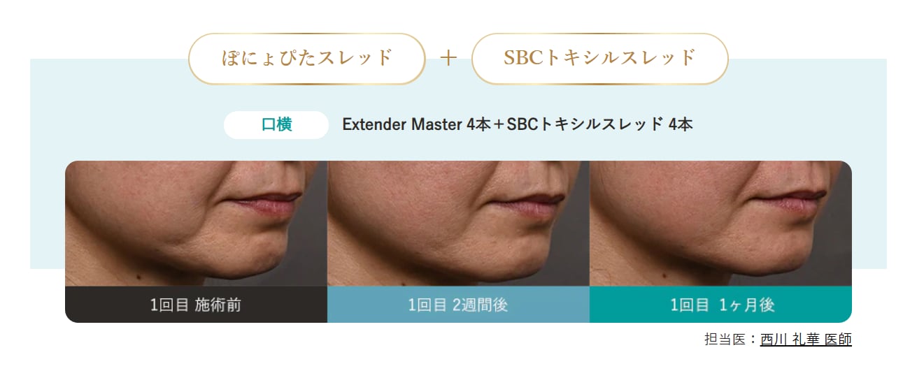 症例写真2