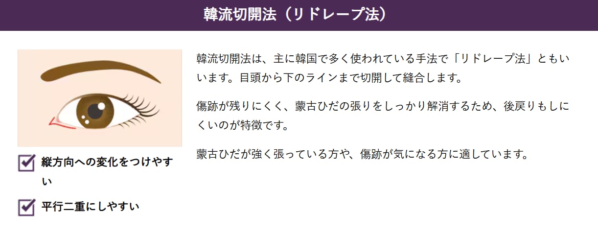 韓流切開法(リドレープ法)