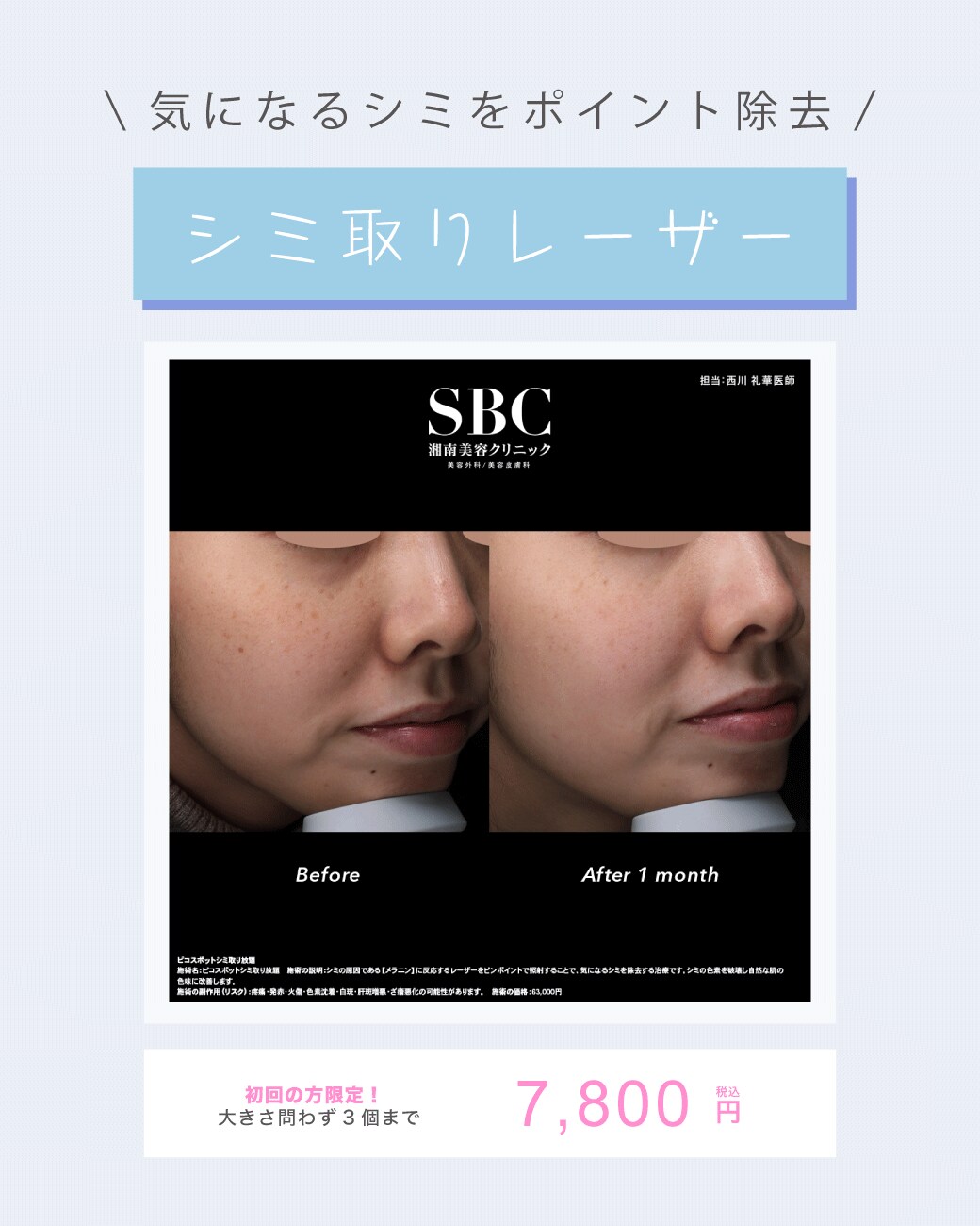 まずはお試し!気になるシミを3個まとめて除去!透明感のある素肌へ
