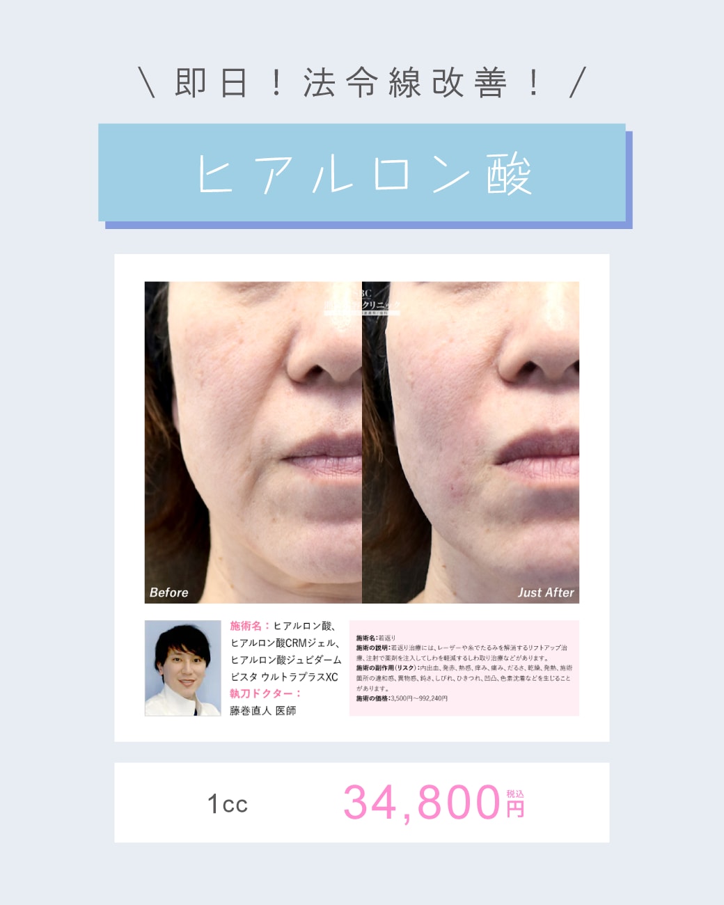 たった数十分で、ふっくら若々しい印象へ!
