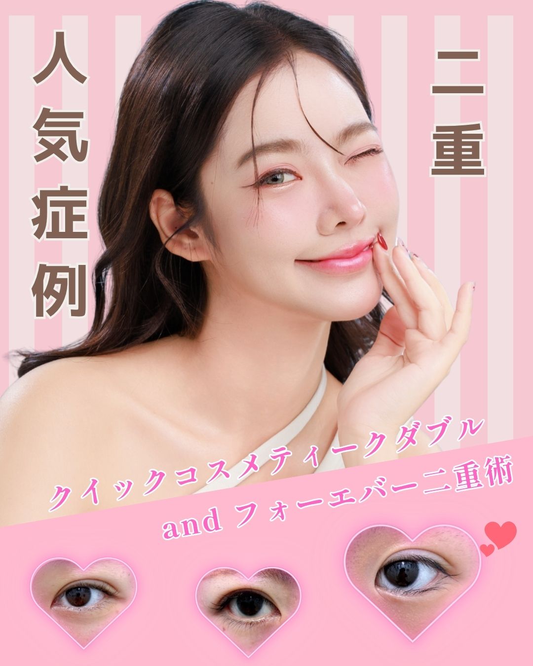 二重整形といえばにしちゃん先生!(埼玉県浦和院)にしちゃん先生の人気の二重症例をご紹介♡