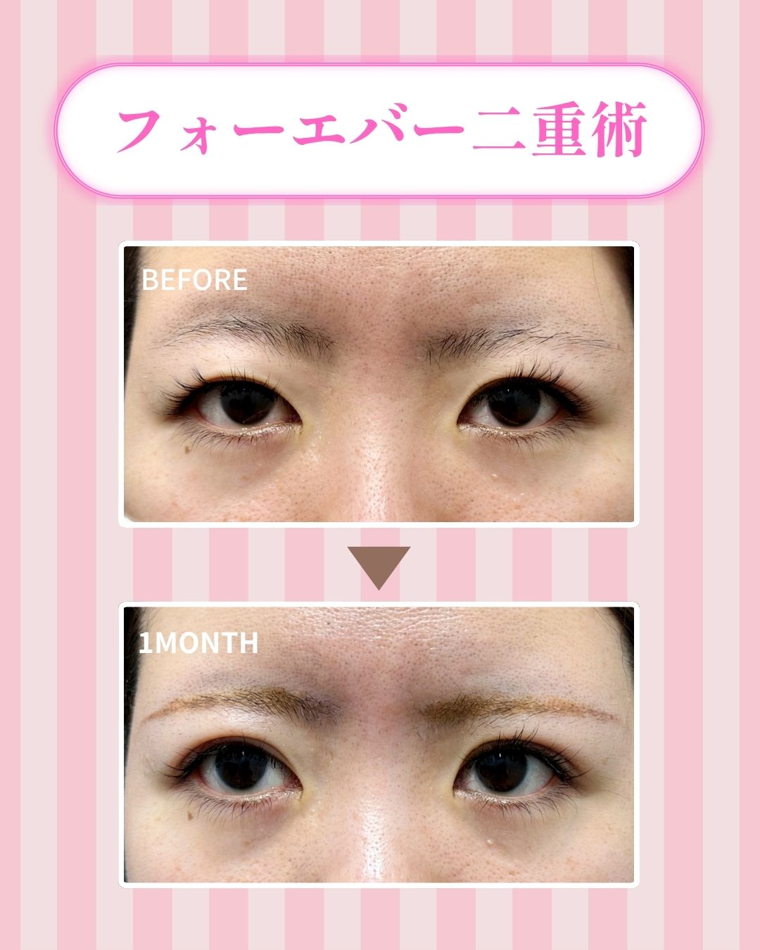 普通〜狭めの末広型