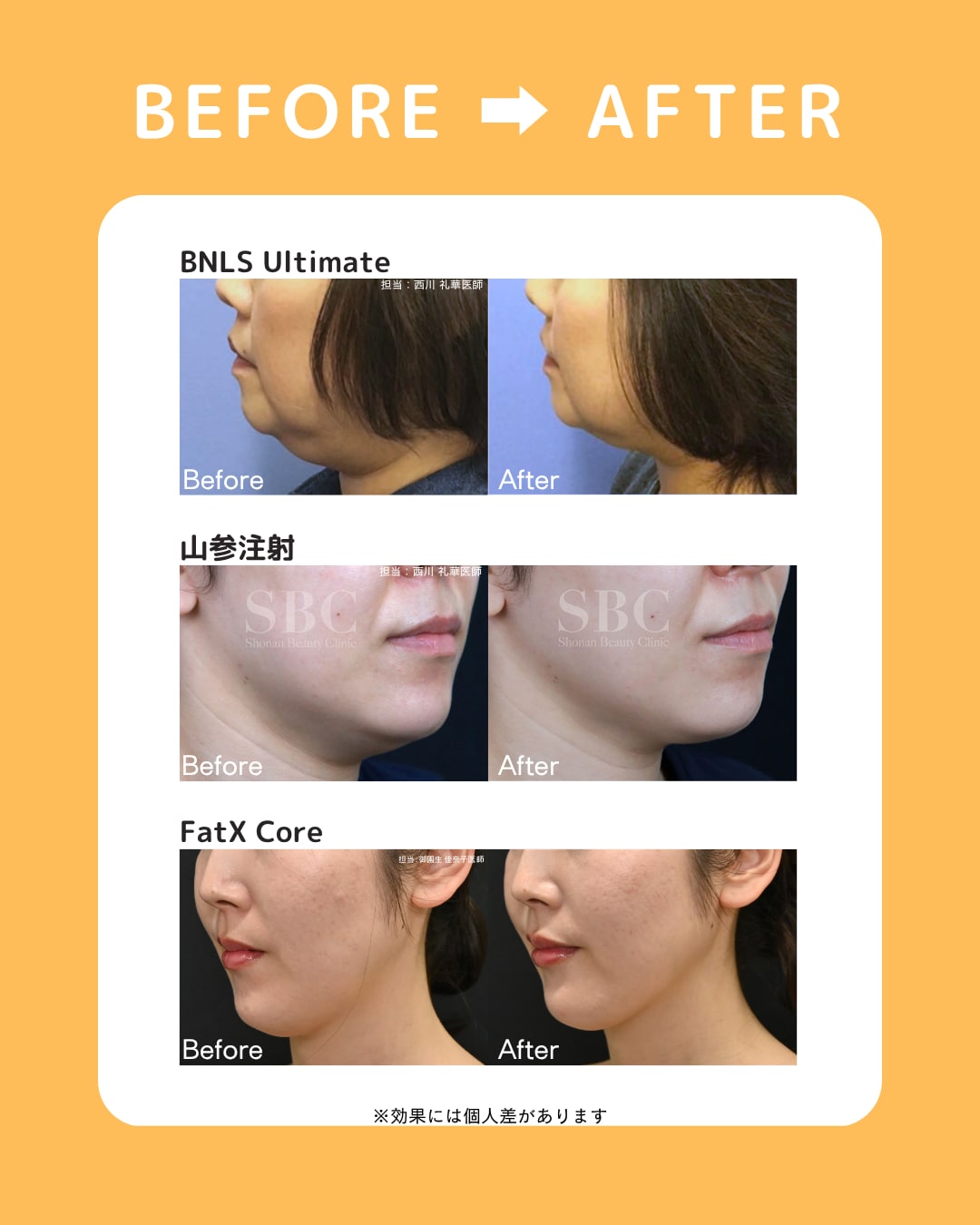 Before Afterで見る効果の実感