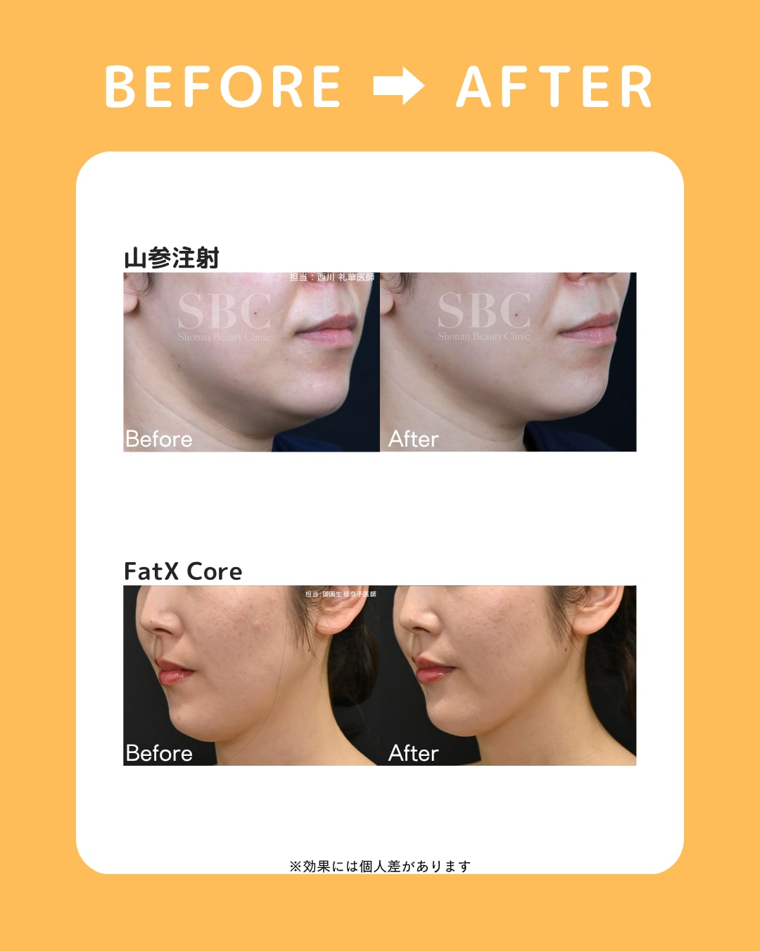 Before Afterで見る効果の実感
