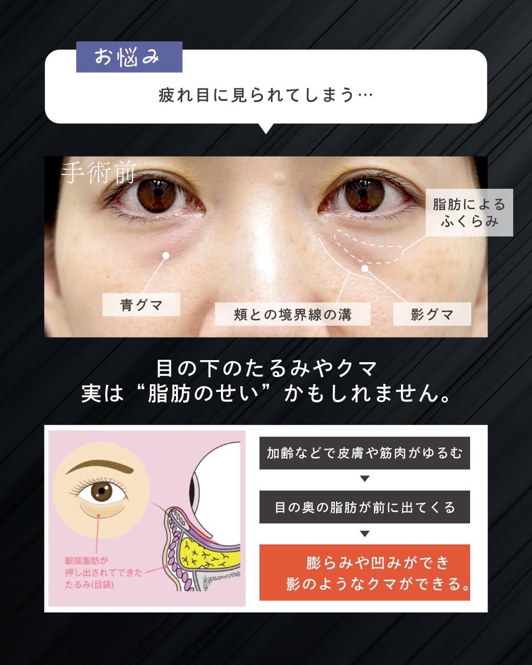 40代女性の症例解説