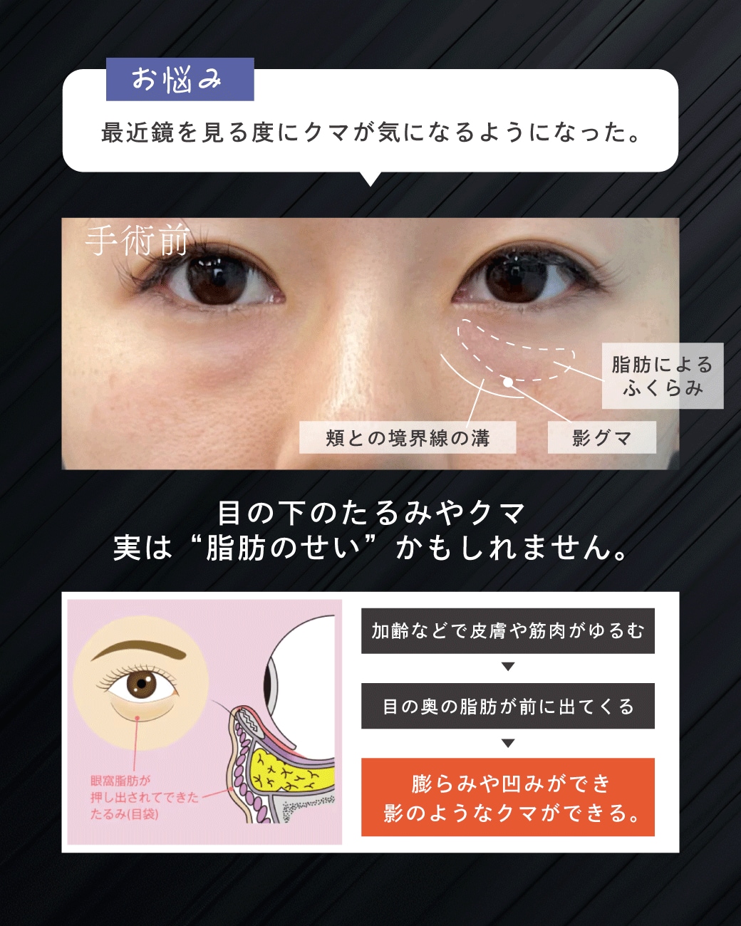 20代女性の症例解説