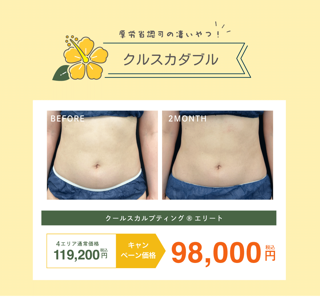 クルスカダブルがお得！