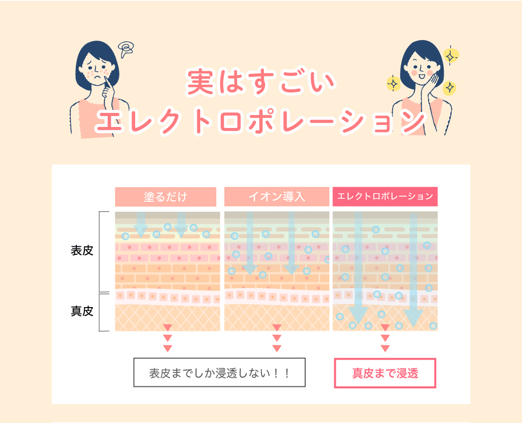 実はすごいエレクトロポレーション
