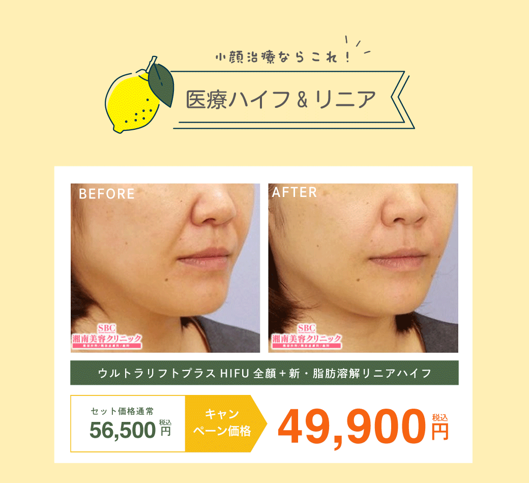 医療ハイフ&リニアのセットがお得！