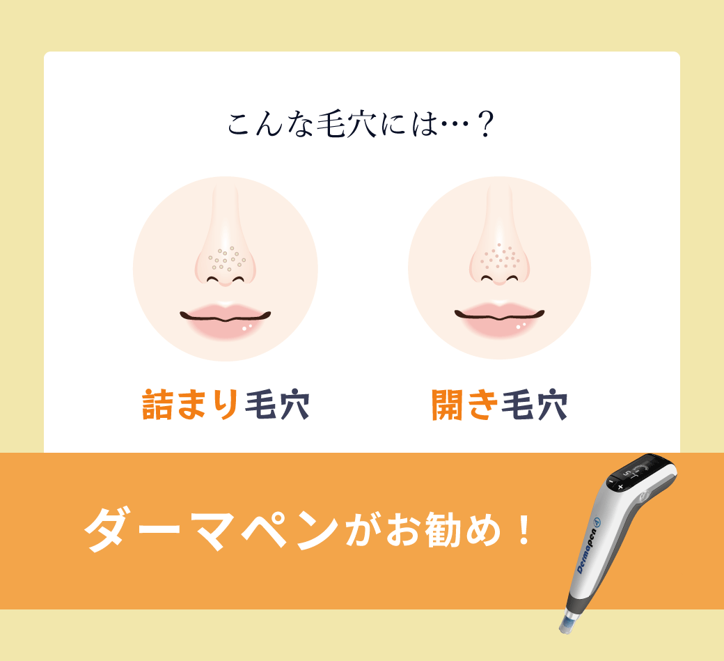 ダーマペンがお勧め！