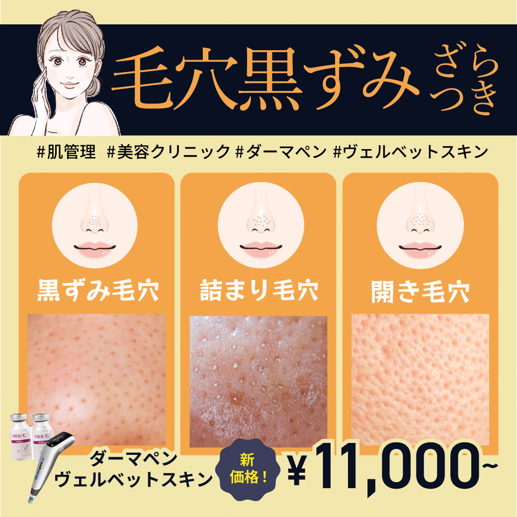 浦和でダーマペンなら湘南美容クリニックへ｜毛穴・美肌再生に効果的なヴェルベットスキンも