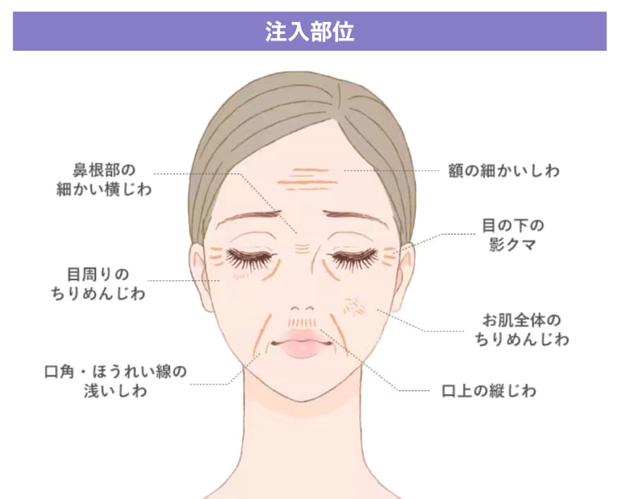 デリケートな部位のシワ改善に最適