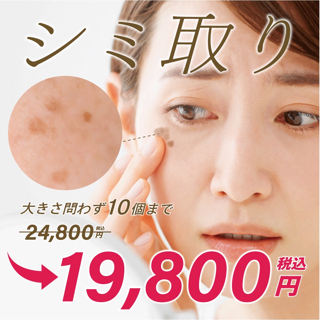 【浦和】シミ取りレーザーで明るい素肌へ｜今だけ10個まで19,800円のキャンペーン実施中！