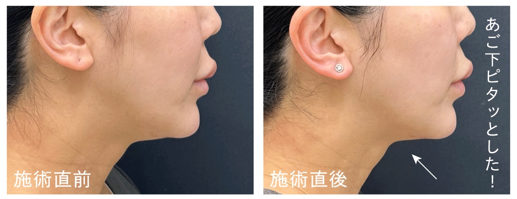 痛み・ダウンタイムが少ない“通いやすい美肌治療”