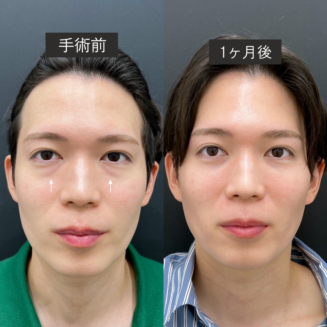 クマがあるだけで印象が一気に変わる