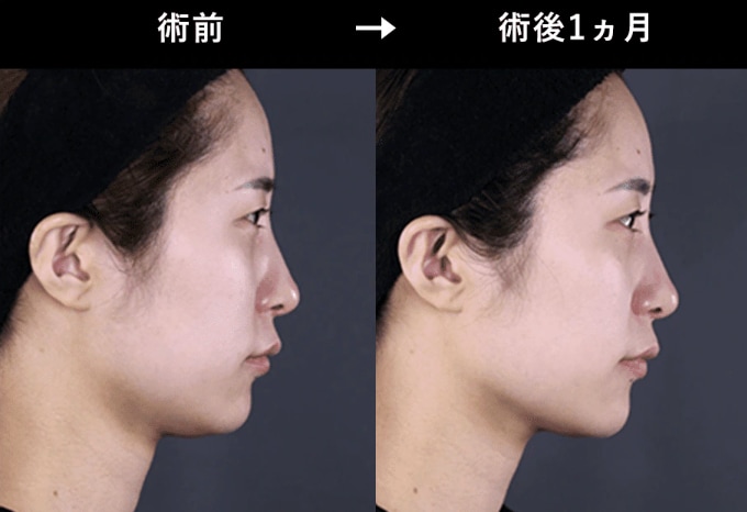 何度も通う必要なし！医療だからこその持続力