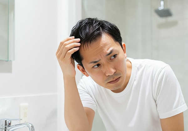 男性向け：AGA（男性型脱毛症）チェック