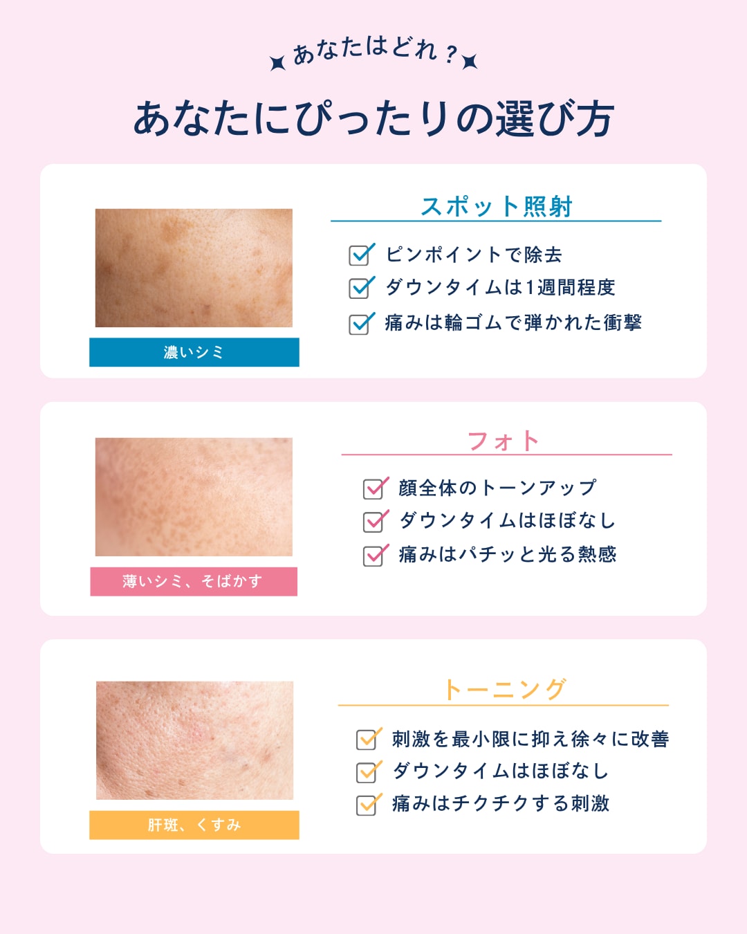 シミの種類とおすすめ治療一覧