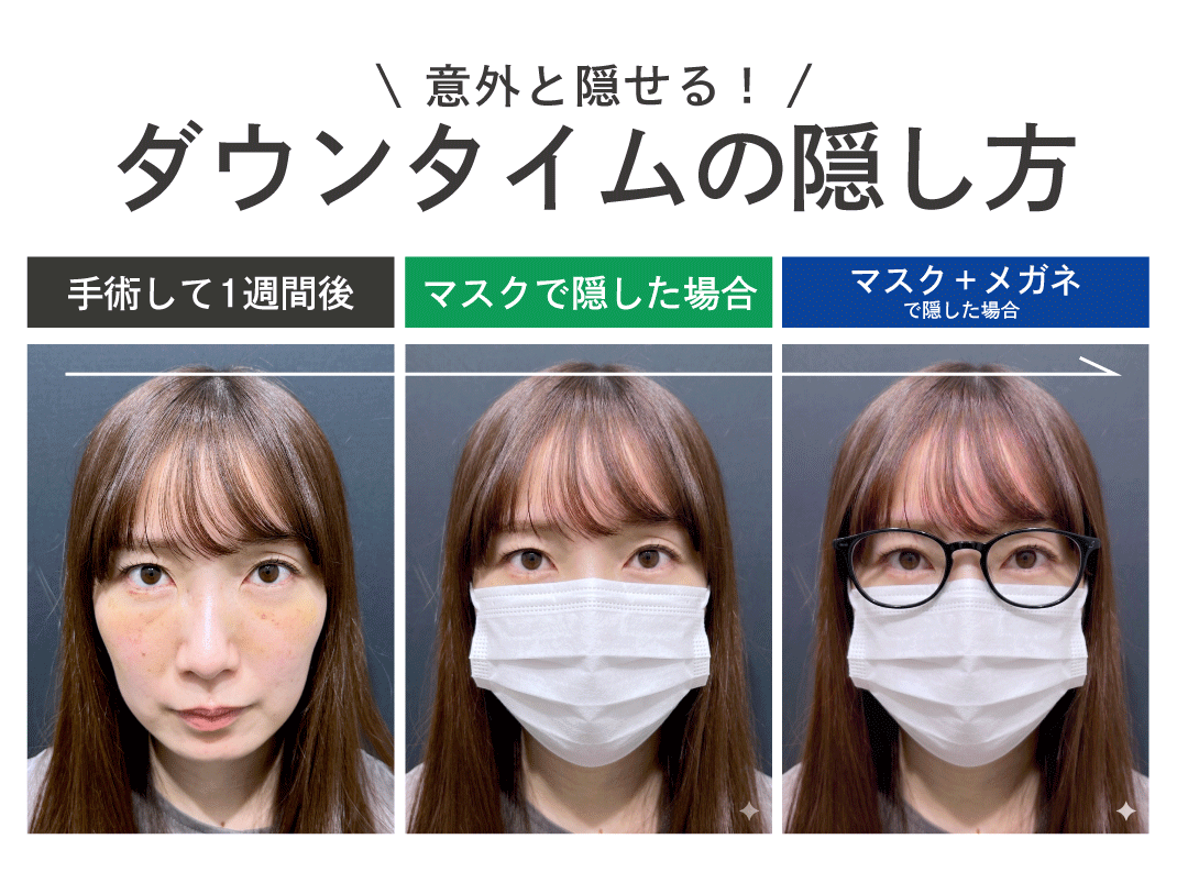 腫れや内出血を自然に隠す4つのステップ