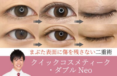 【かわいい系からキレイ系まで自由自在！】Instagramでの指名多数！大橋先生による二重術