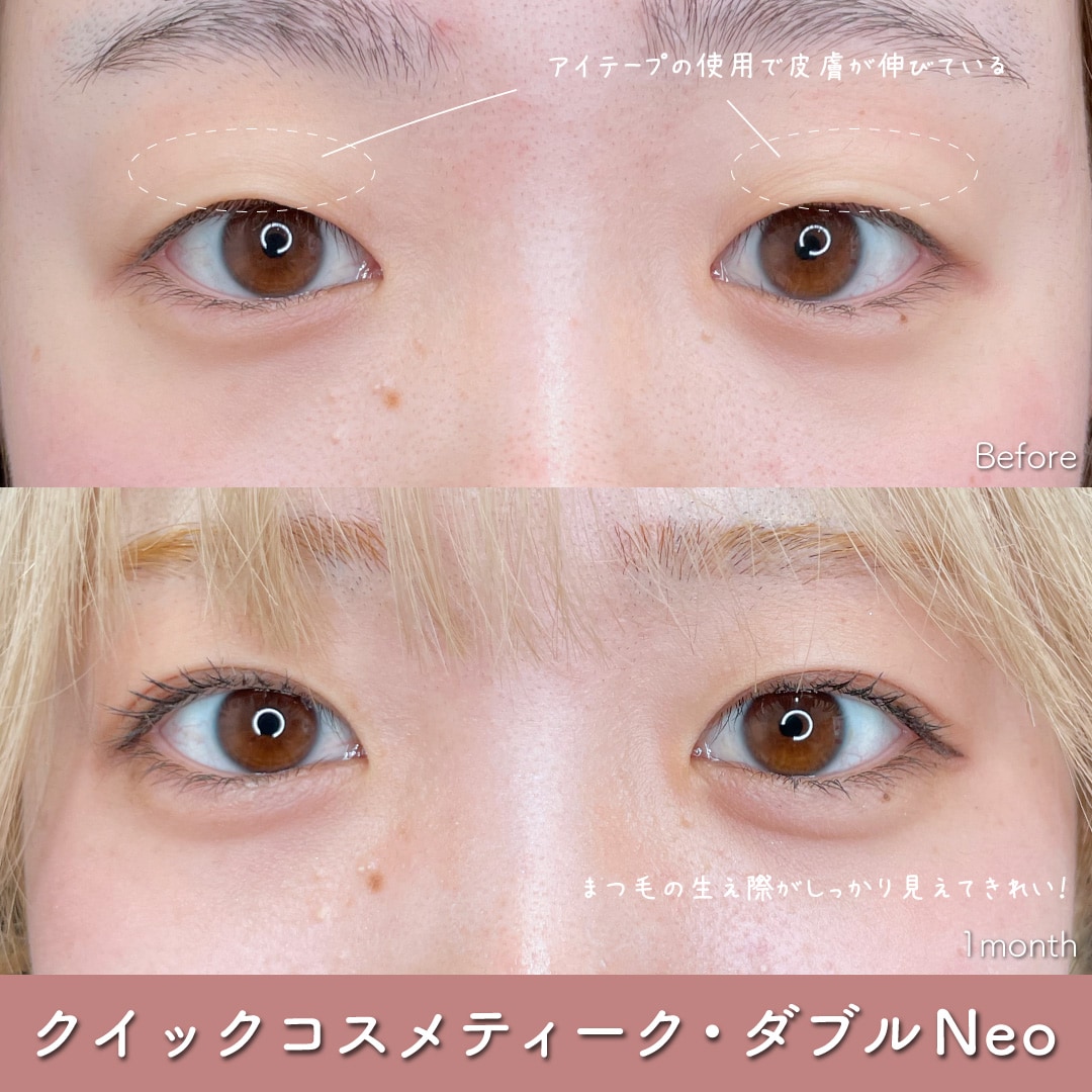 糸留めが表に出ない!デザイン性が高い!強度も強い!!<br />