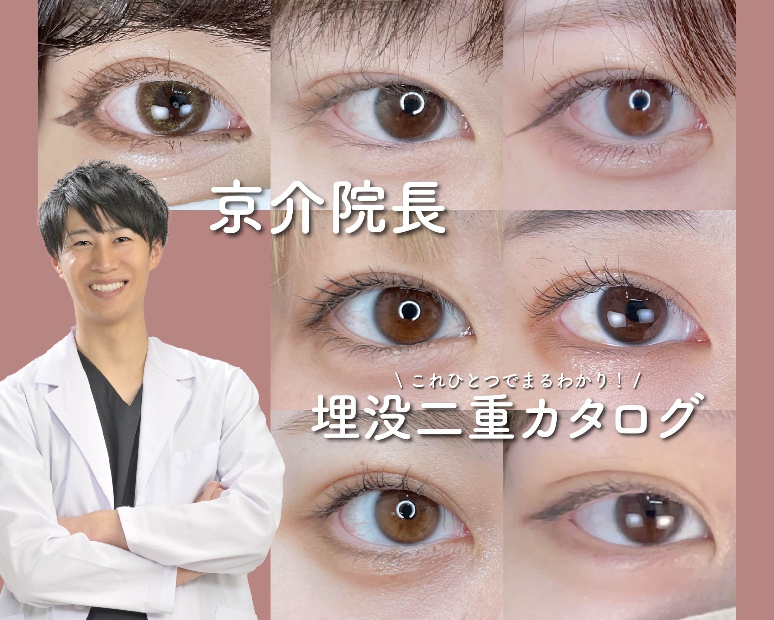 宇都宮で二重整形受けるなら湘南美容クリニック宇都宮院京介院長！！埋没二重術カタログ💖