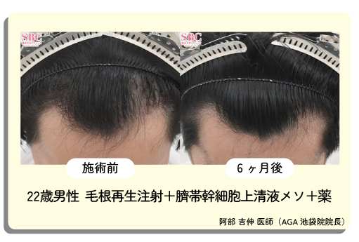 AGA