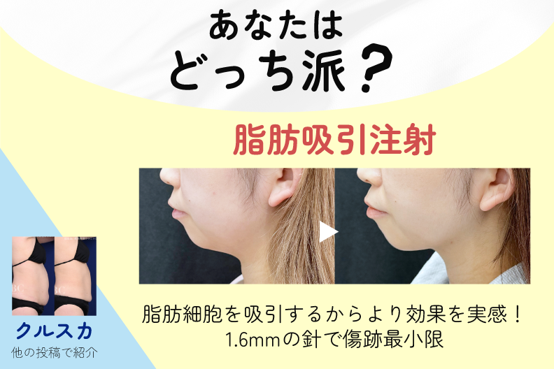 あなたはどっちで痩せる？宇都宮でできる脂肪吸引注射
