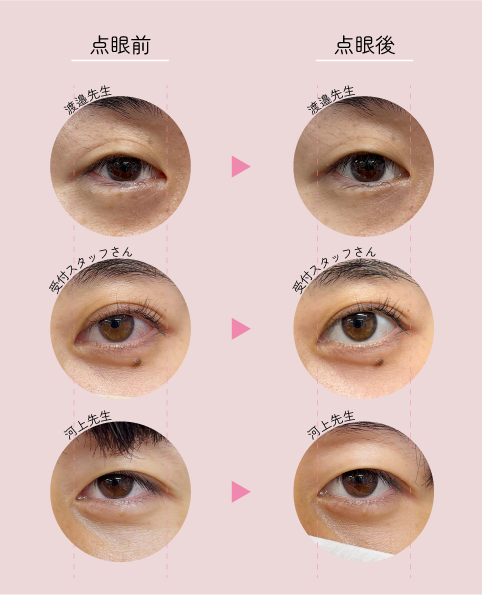 点眼10分後の目元
