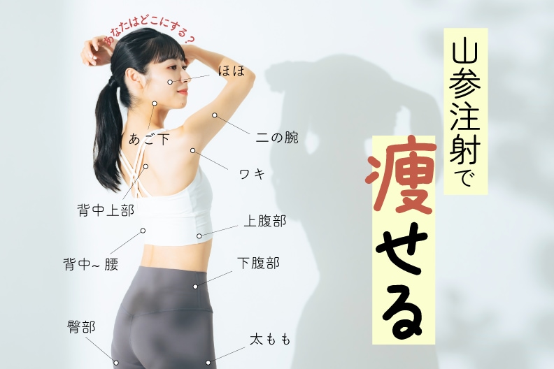 宇都宮で出来る脂肪溶解注射『山参注射』