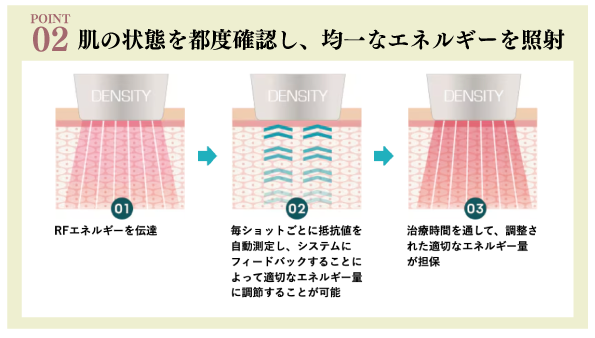 肌の状態を確認し均一なエネルギーで照射
